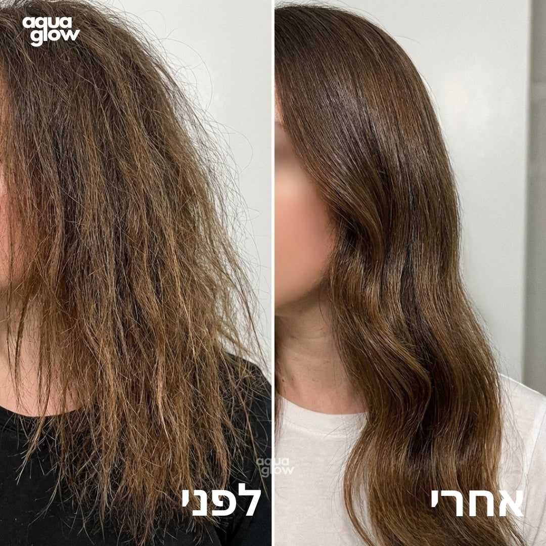 לפני ואחרי