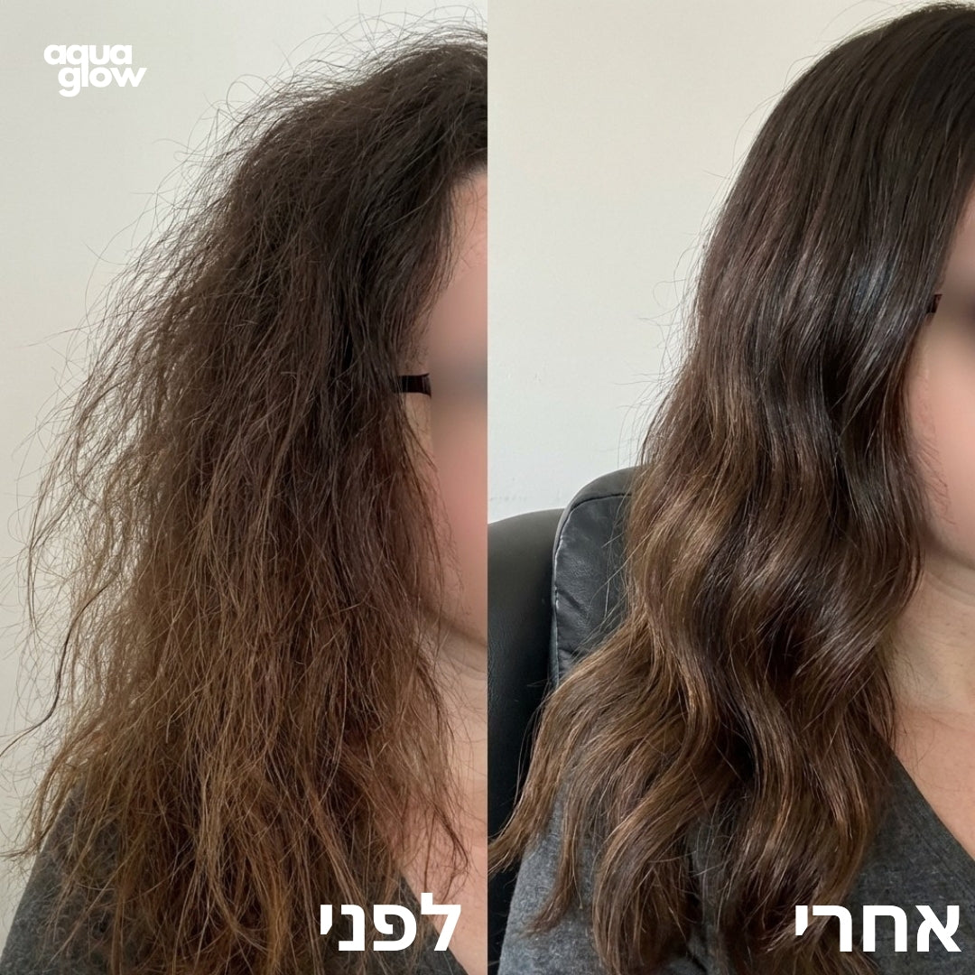לפני ואחרי
